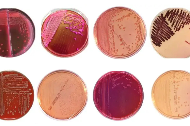 macconkey agar
